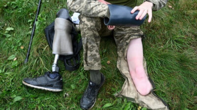 Descoberta chocante: Rússia se vangloria de liderar o mercado global de próteses após milhares de mutilados na guerra da Ucrânia