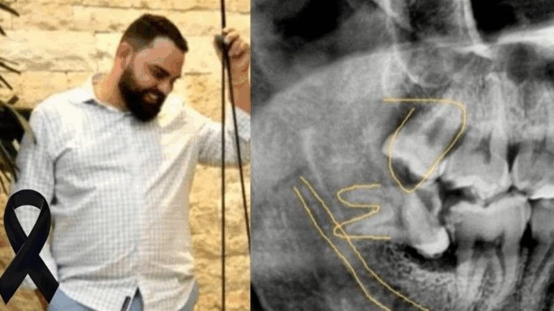 Homem vai ao dentista para tratamento rotineiro e morre tragicamente após reação inesperada a medicação: caso chocante ganha repercussão nacional