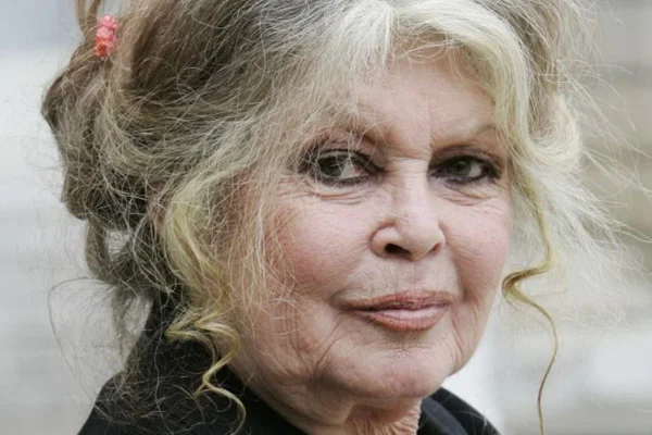 Urgente! Brigitte Bardot readmitida em estado grave após cirurgia mostrada