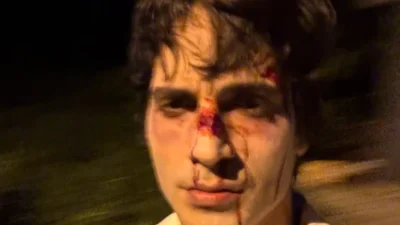 Fiuk surge com rosto ferido após polêmica explosiva com música sobre o pai