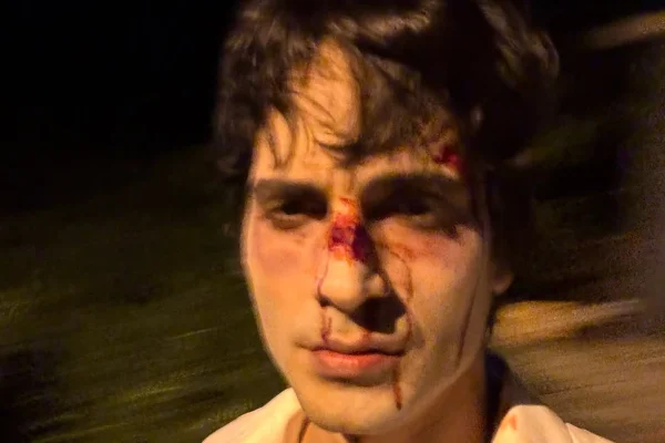 Fiuk surge com rosto ferido após polêmica explosiva com música sobre o pai