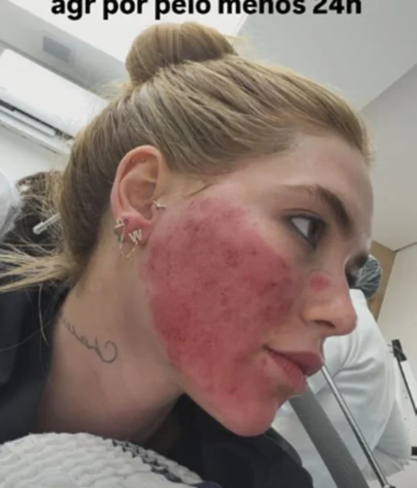 Virginia Show: Horror na Pele Após Tratamento Estético!